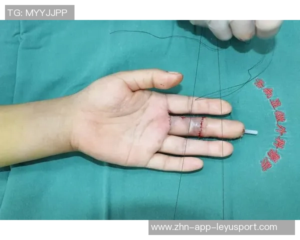 广西平果队员黄威右侧胫腓骨骨皮质断裂预计恢复时间为八个月 广西平果队员黄威右侧胫腓骨骨皮质断裂预计恢复时间为八个月